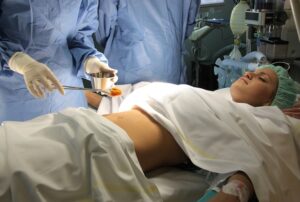 best laparoscopy services in Fatehpuri Chowk, Panipat,